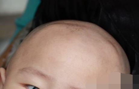 宝宝这3个地方长得丑,暗示孩子有福气,免疫力高