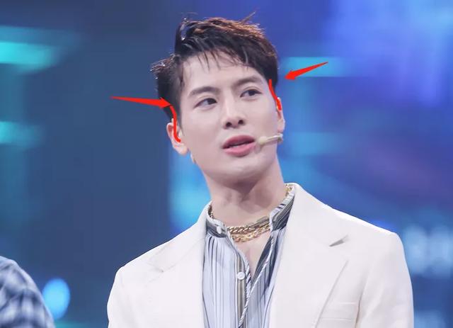 王嘉尔变成牙套脸颧骨外扩太阳穴也凹陷太多明星因此颜值骤降