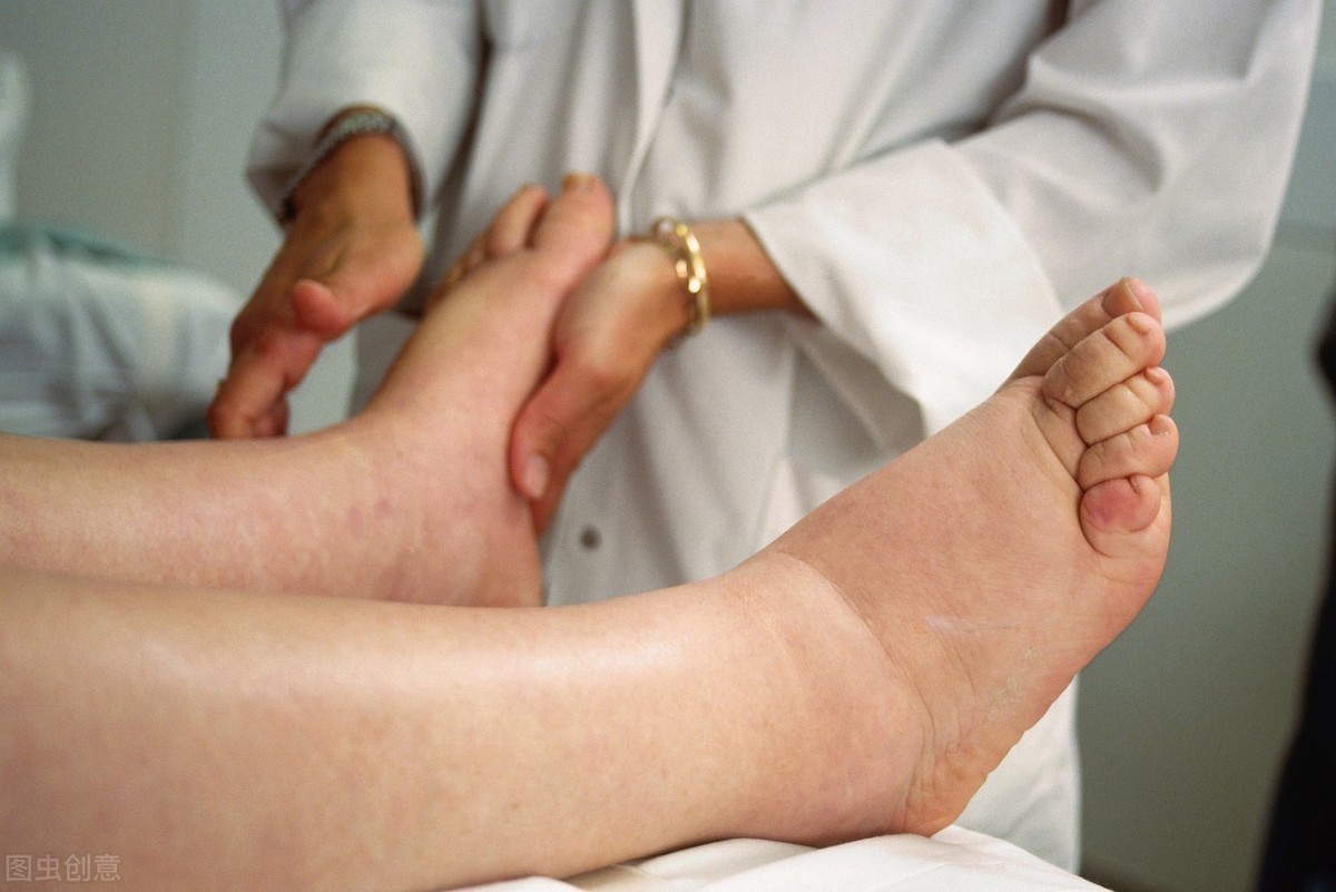 你以为尿毒症离你很远10个迹象看看自己有没有肾病征兆