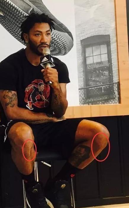 詹姆斯头部伤痕明显,科比伤病图令人动容