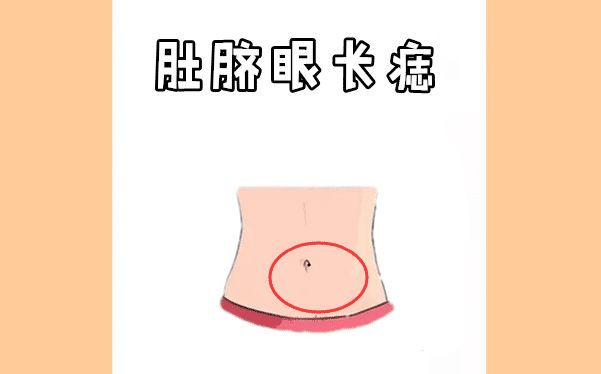 身上五大"财富"痣,赚钱本领强,财大气粗,一生有财又有福!