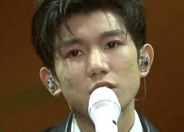 王源长痘郭京飞卡粉,明星那么有钱,为什么皮肤还是不好?