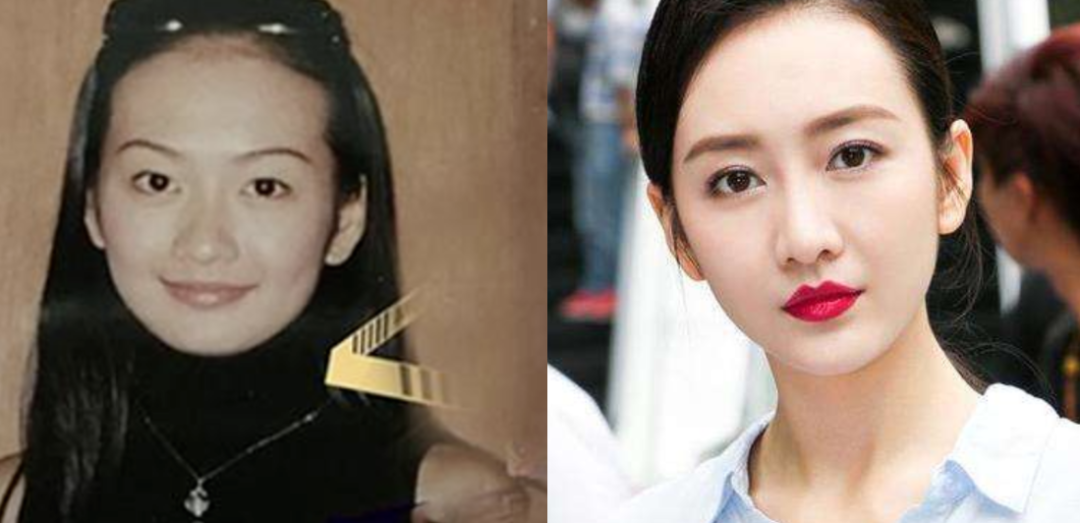 骨相|王鸥|颧弓_新浪新闻