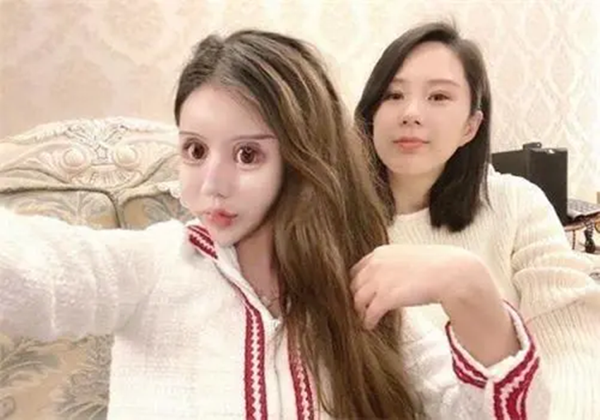 3年整60次,如今模样早已认不出|整容|娜娜|外貌_新浪新闻