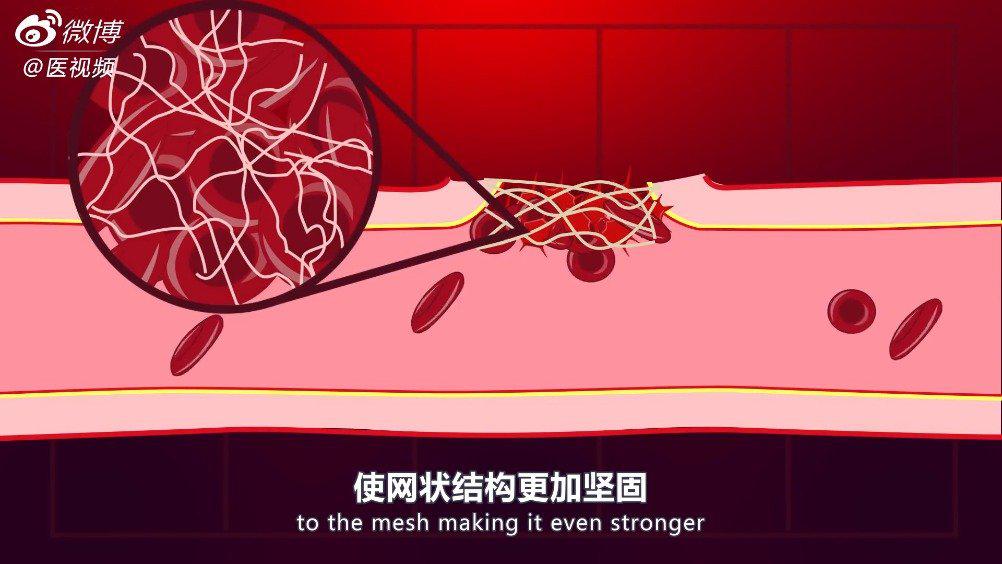 医学双语科普：血小板和凝血机制 视频翻译by@xyslyl 在我们受伤_新浪新闻