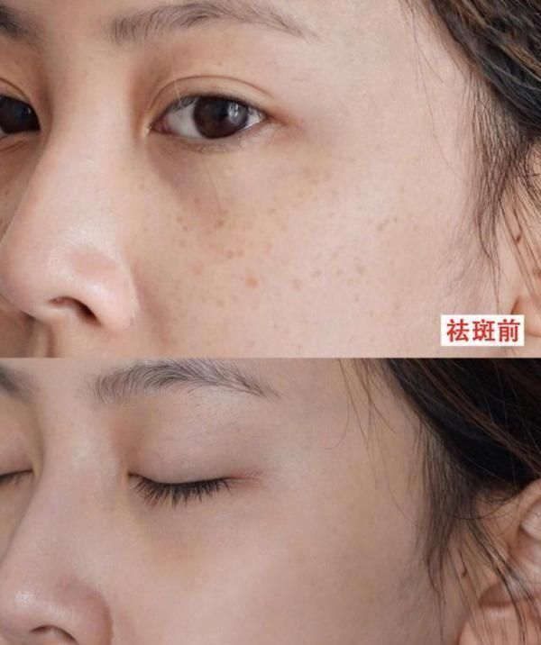 脸上长出色斑别着急,有款"国货"祛斑霜,淡斑嫩白效果好