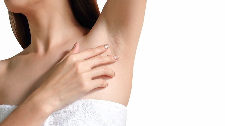 腋下异味有分男女!你是起司味还是洋葱味?发臭祸首不是汗