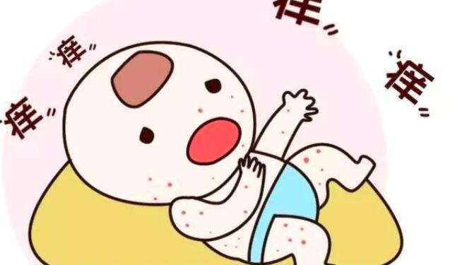小儿推拿杨晓:夏季又到了痱子高发季节,与湿疹还傻傻分不清吗?