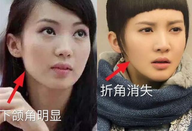 金晨舞台首秀简直美得跟开了挂一样▼