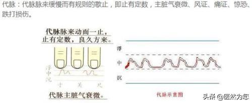 脉象动图解读虚脉微脉细脉代脉短脉普通人也可以看懂