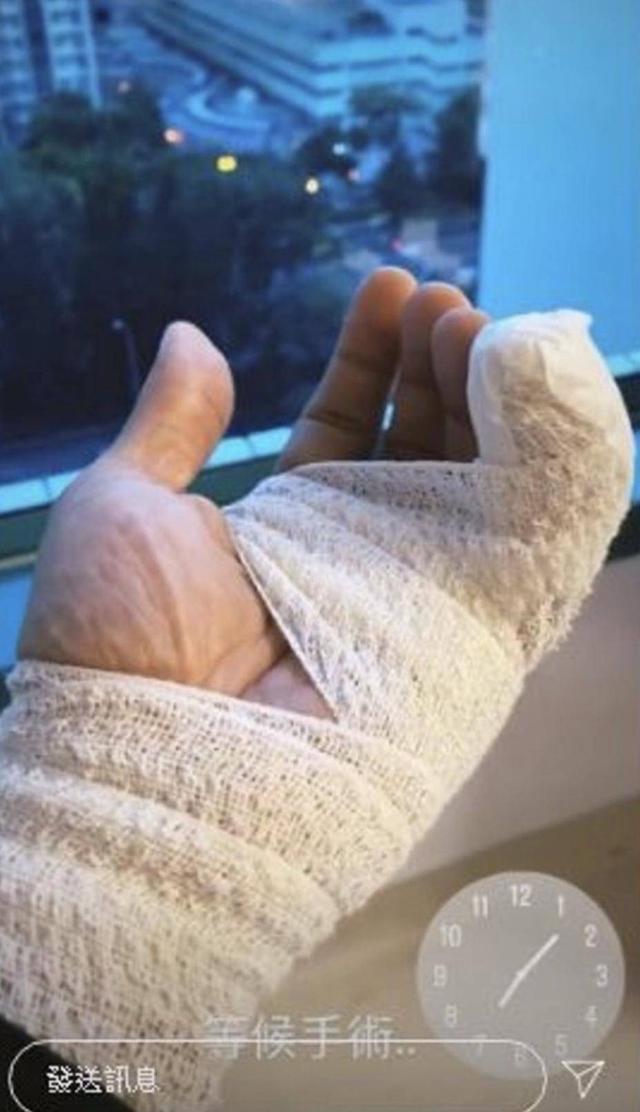 tvb力捧小生意外被训练过的狗咬伤荧幕情侣被网友力赞在一起