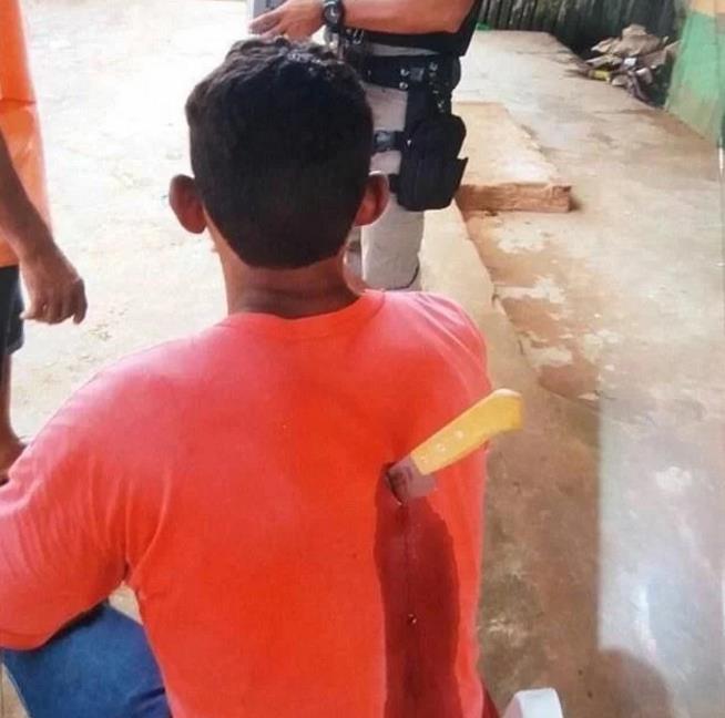 男子被人撞了一下朋友发现他后背多了一把刀他的反应让人无语