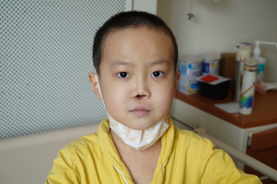 8岁男童为保命鼻子被掏空,他天真地盼长回,爸爸强颜欢笑