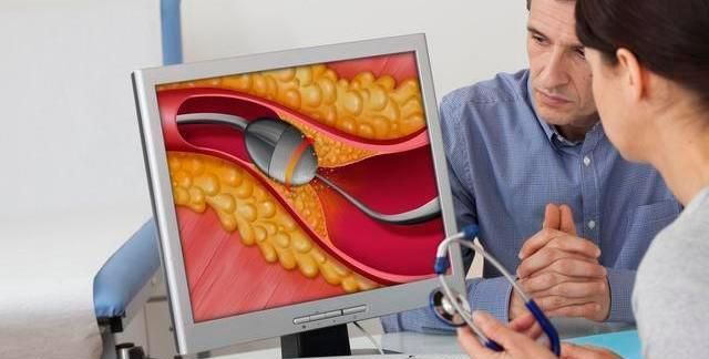 血管堵不堵,看这个地方就知道,教你三招,疏通血管预防疾病