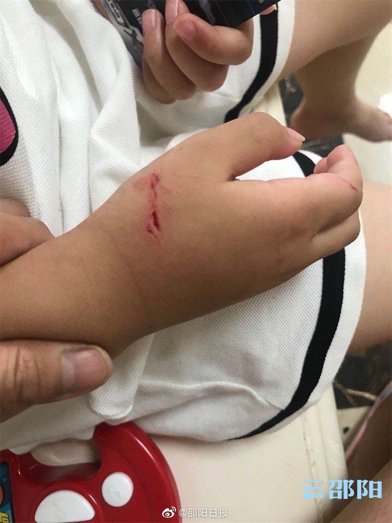 小心家里的玻璃炸裂伤人