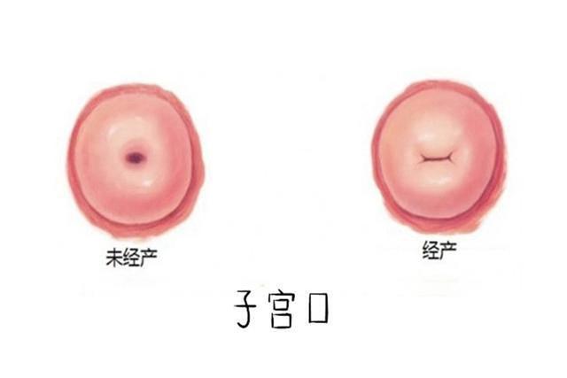 顺产时医生问是不是头胎女方的回答是医生皱眉不知道怎么进行