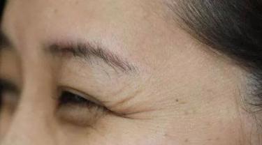 眼部有细纹干纹如何改善_眼部有细纹干纹如何改善图片