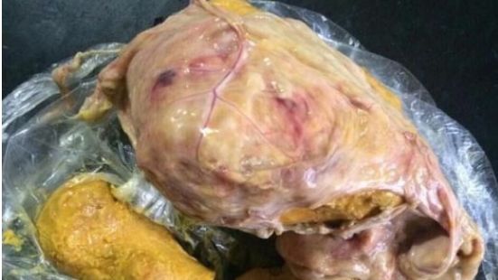 男子过年杀鸡掏出黄色的石头扔掉后发现自己错失上百万