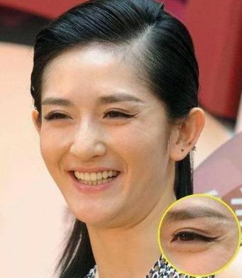 年纪轻轻,干纹细纹明显,怎么办?▼