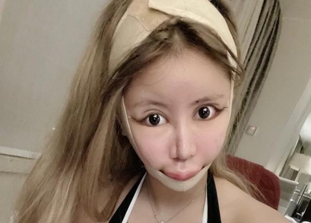 自曝13岁开始整容,3年整容100次,花费超百万|整容|娜娜|网红_新浪新闻