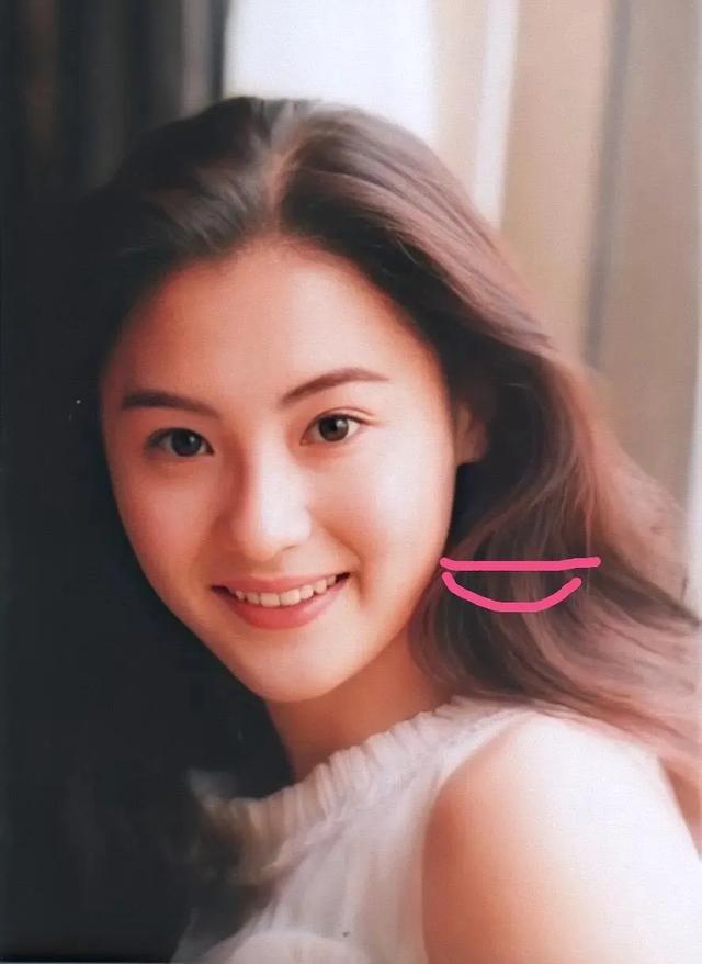 整牙如整容张柏芝为转运花40万做烤瓷半张脸的和谐都被破坏了