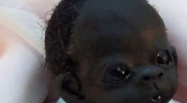 世界上最黑的小宝宝,如今5年过去,长大后却成这样了|小宝宝|肤色|黑人
