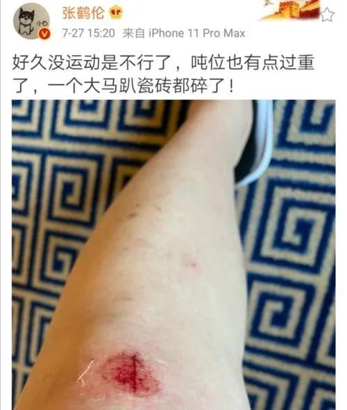 张鹤伦录节目太拼,一个大马趴,波棱盖儿卡秃噜皮了