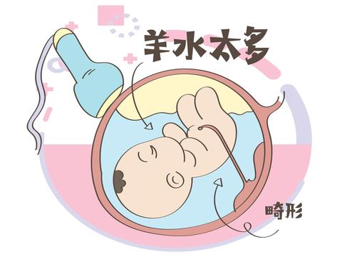 胎儿|肚子|羊水_新浪新闻