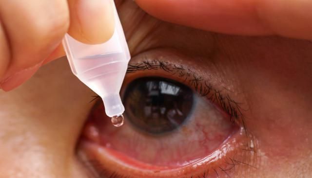 空调吹多了眼睛又干又涩,小心是干眼症找上门!多做5件事远离它