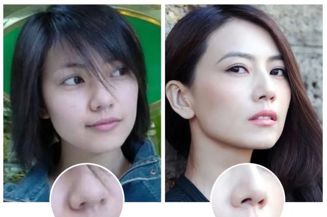 你是哪种塌鼻子,看着4个地方就知道了!