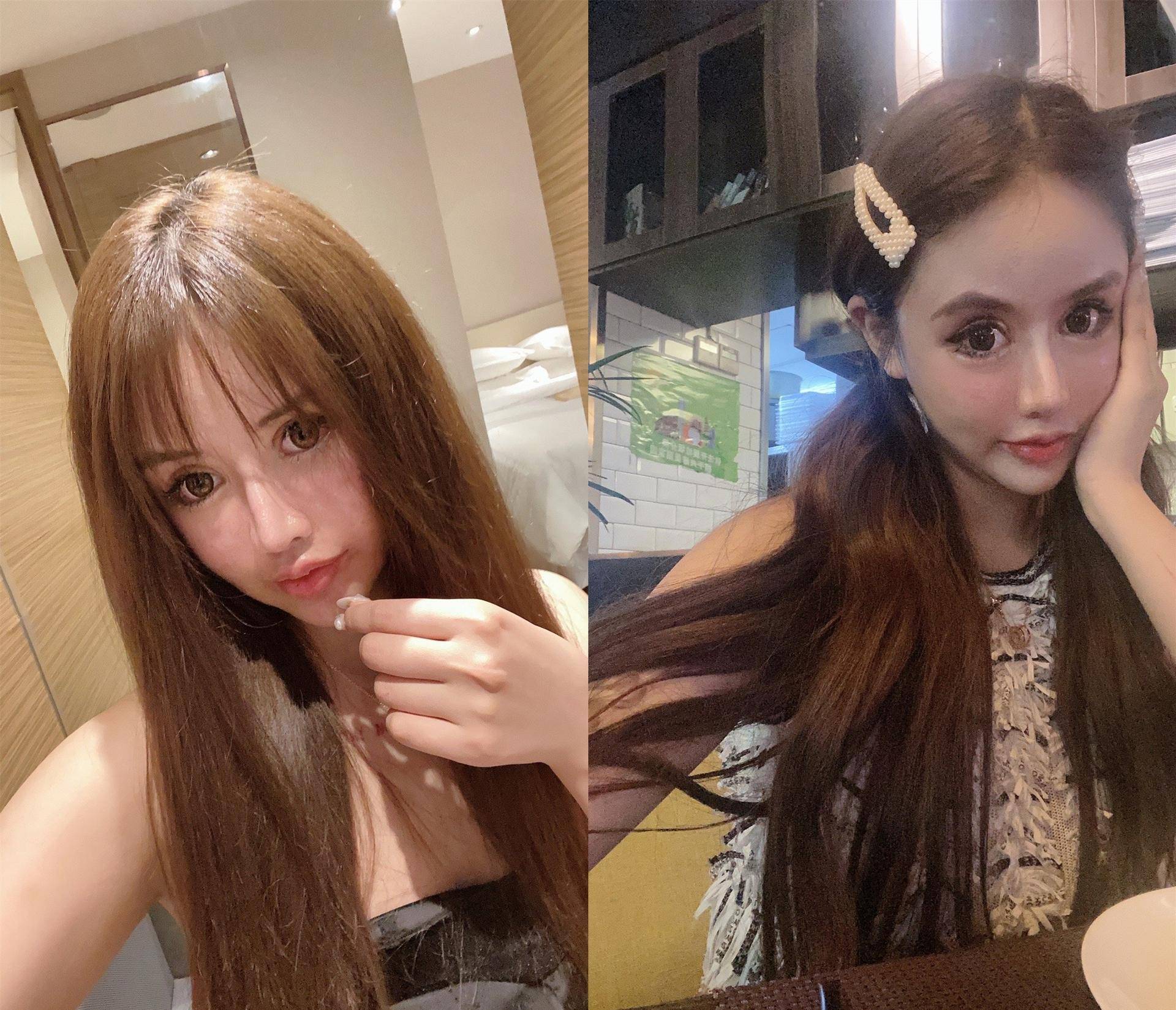 花费上百万,这位网红在追求"美"的路上欲罢不能|整容|娜娜|整容手术