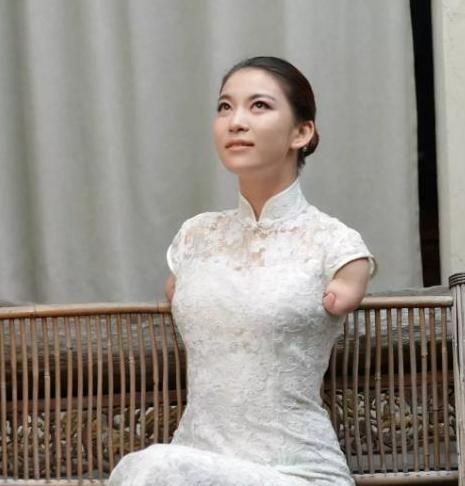 她是《非诚勿扰》无臂女孩,与小伙牵手后不久被甩,如今怎样了?