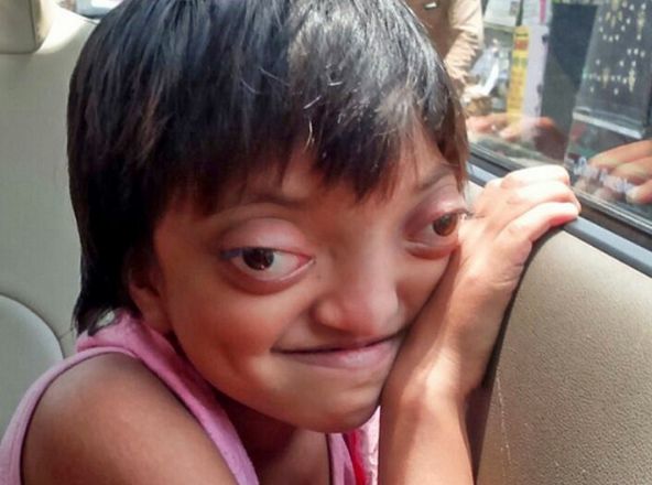 女孩从小长着青蛙眼,却被夸漂亮,很多人向女孩家订婚要娶她