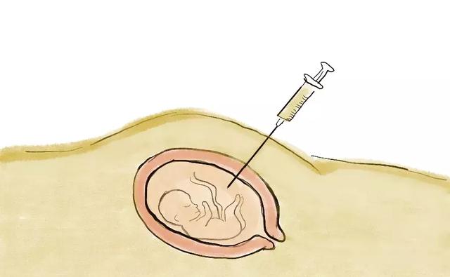 终止妊娠带来的一切,我们都不能选