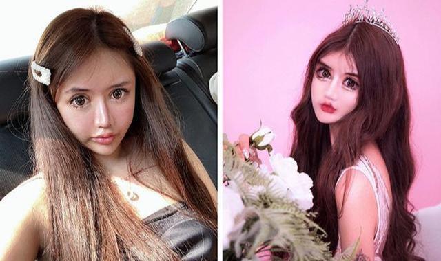 网红整容成瘾13岁起整容100次!网友:你的才艺就是脸吓人