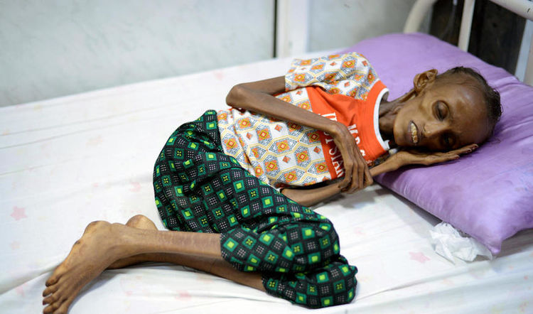 这个少女只剩下了骨头,却拍摄了一组让人落泪的写真照