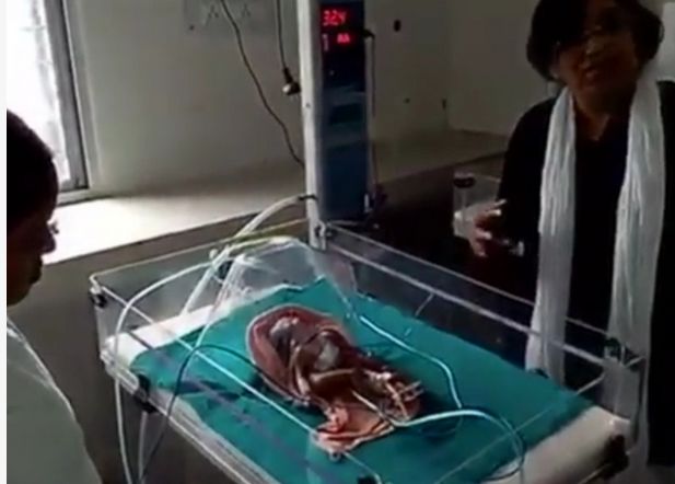 女子怀孕10月,生下4手4脚异形婴儿,医生却这样解释!