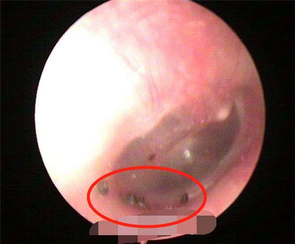 儿子半夜耳朵痛,妈妈用灯照吓出一身鸡皮疙瘩,娃床头勿摆这东西