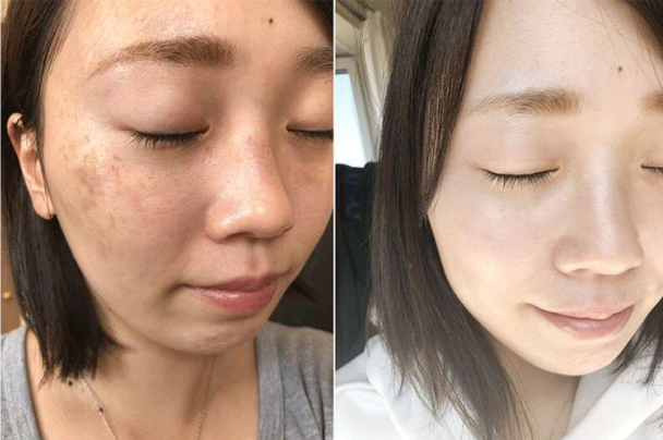 日本女人不长"色斑"的秘密,原来她们都爱做这事
