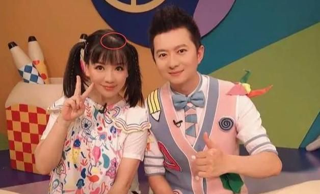 红果果结婚9年后生娃产后复工时有些秃网友别太拼