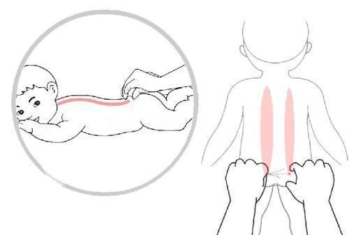 捏脊是不是适合所有宝宝父母该如何给孩子正确的捏脊呢