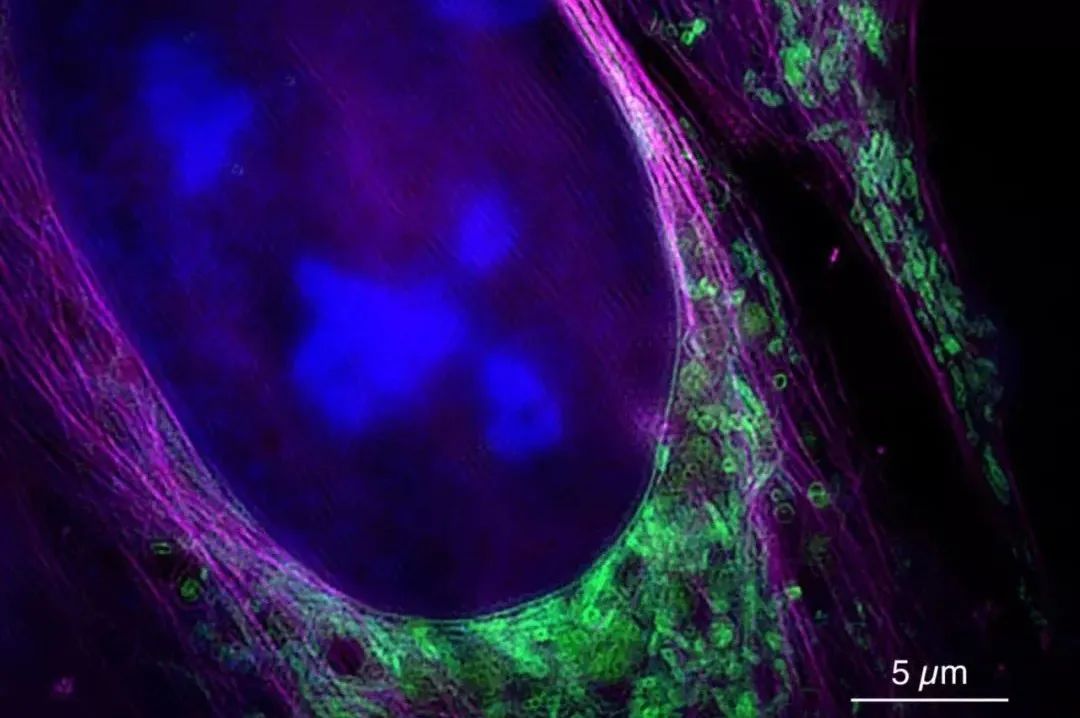 一秒相当于310亿年能否看到光合作用中分子化学反应的画面