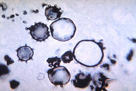 卵磷脂小体镜检图片图片
