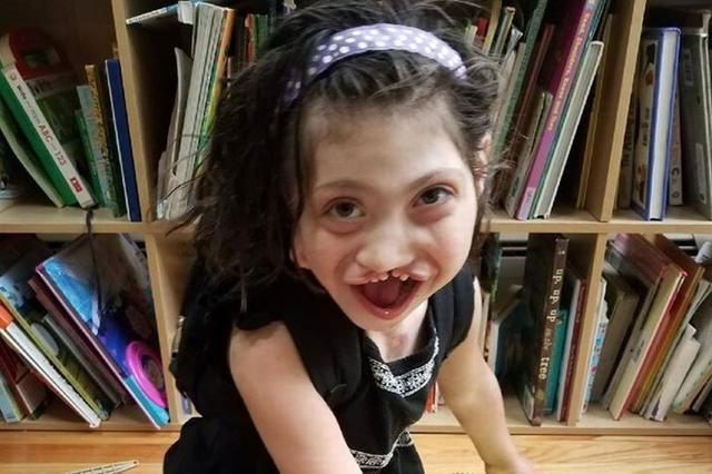 美8岁畸形女孩命运多舛被代孕母亲生下亲生父母不管不顾