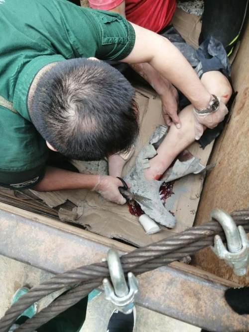 建筑工人被砸双腿骨折沈阳急救医生剪靴施救