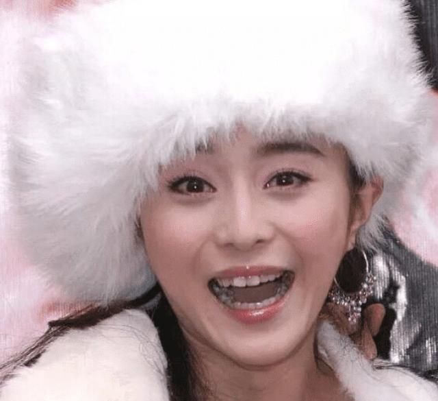 被牙毁了整张脸的明星林心如范冰冰上榜杨颖堪比换头