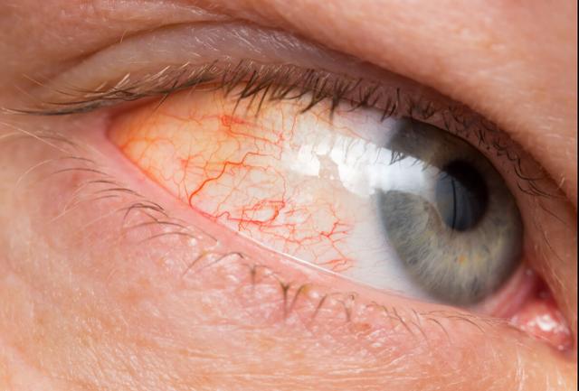 肝受损脸上会出现这四个症状占一个也要及时去医院检查