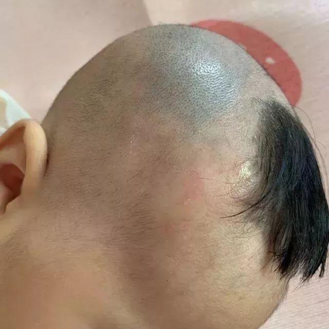 奶奶给满月孙女剃光眉毛2个月后家人以泪洗面网友迷信害人