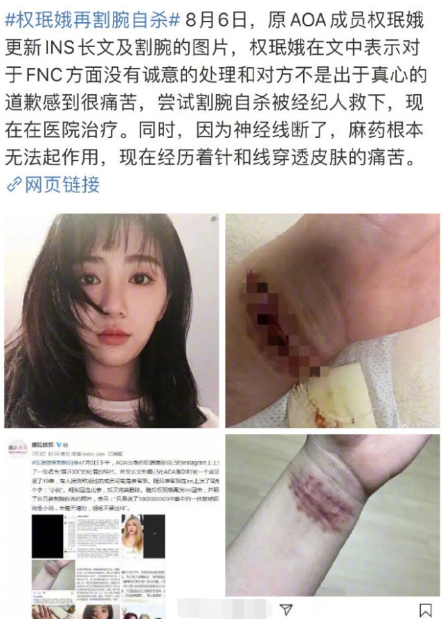 8月6日,aoa前成员权珉娥再度割腕自杀,她本人透露是因为对于fnc方面没
