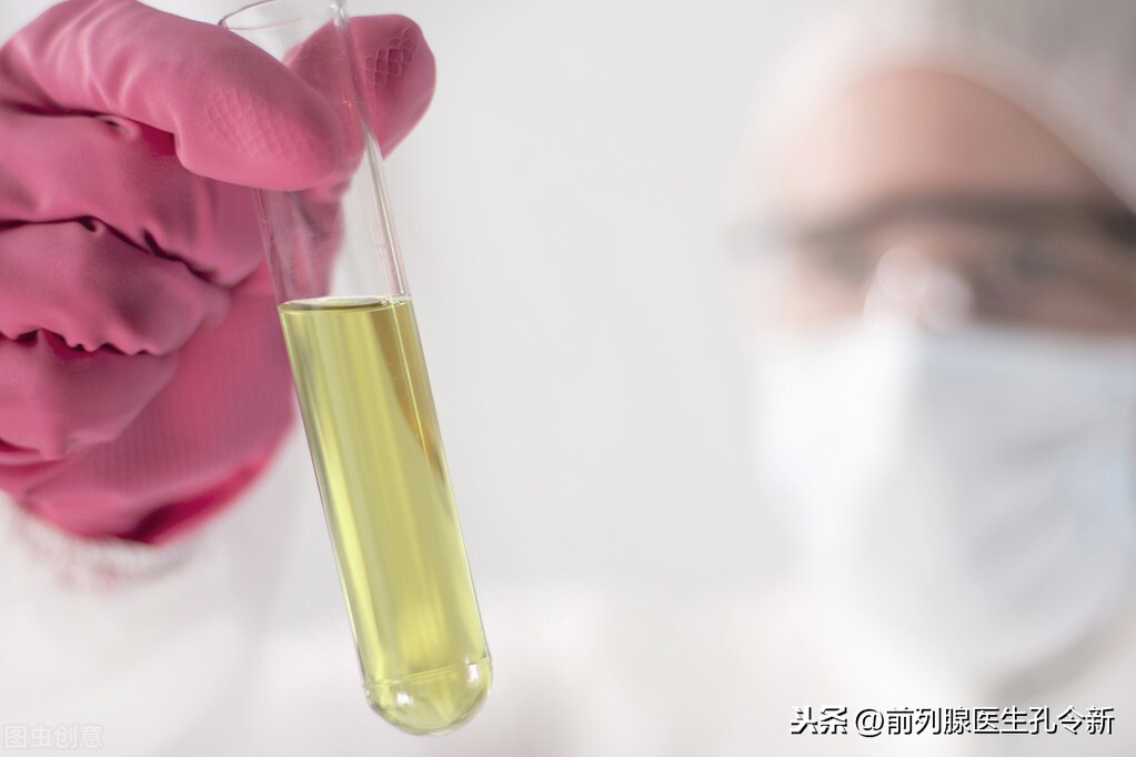 尿常规和前列腺b超满足什么情况下可以确诊前列腺炎?